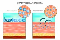 Что такое гиалуроновая кислота?