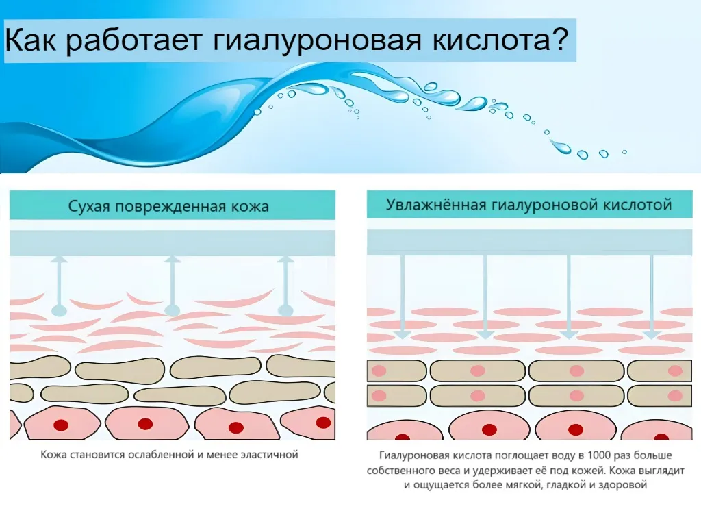 Что такое гиалуроновая кислота?