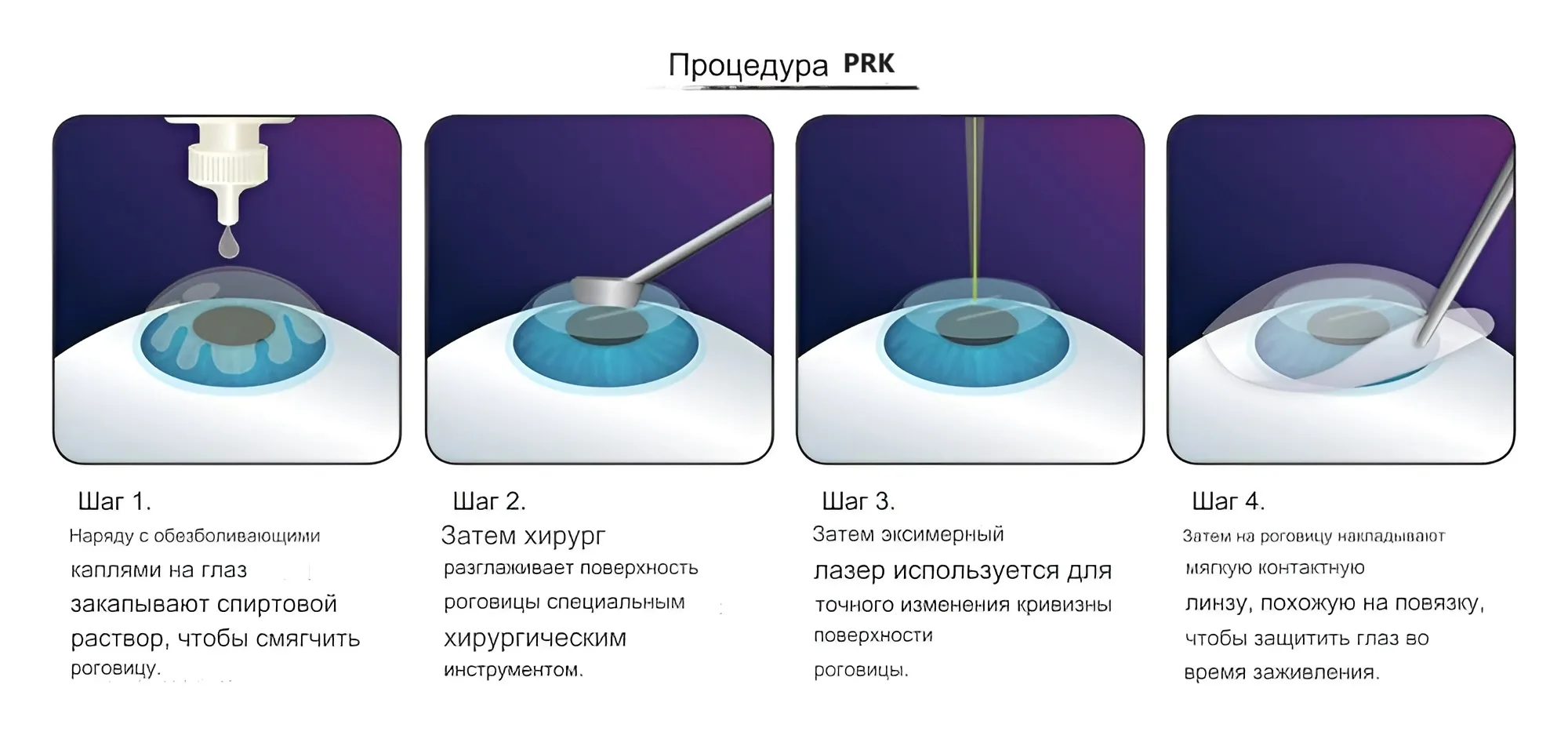 Дальнозоркость