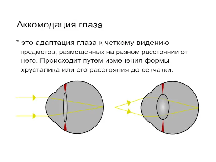 Что такое нарушение аккомодации?