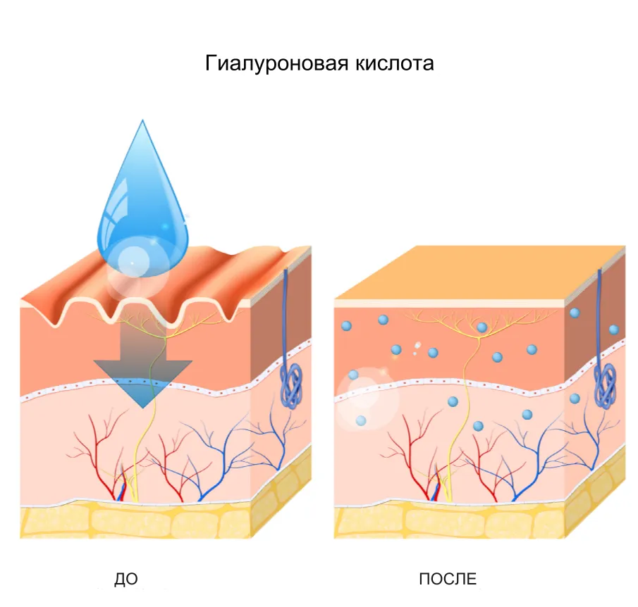 Что такое гиалуроновая кислота?