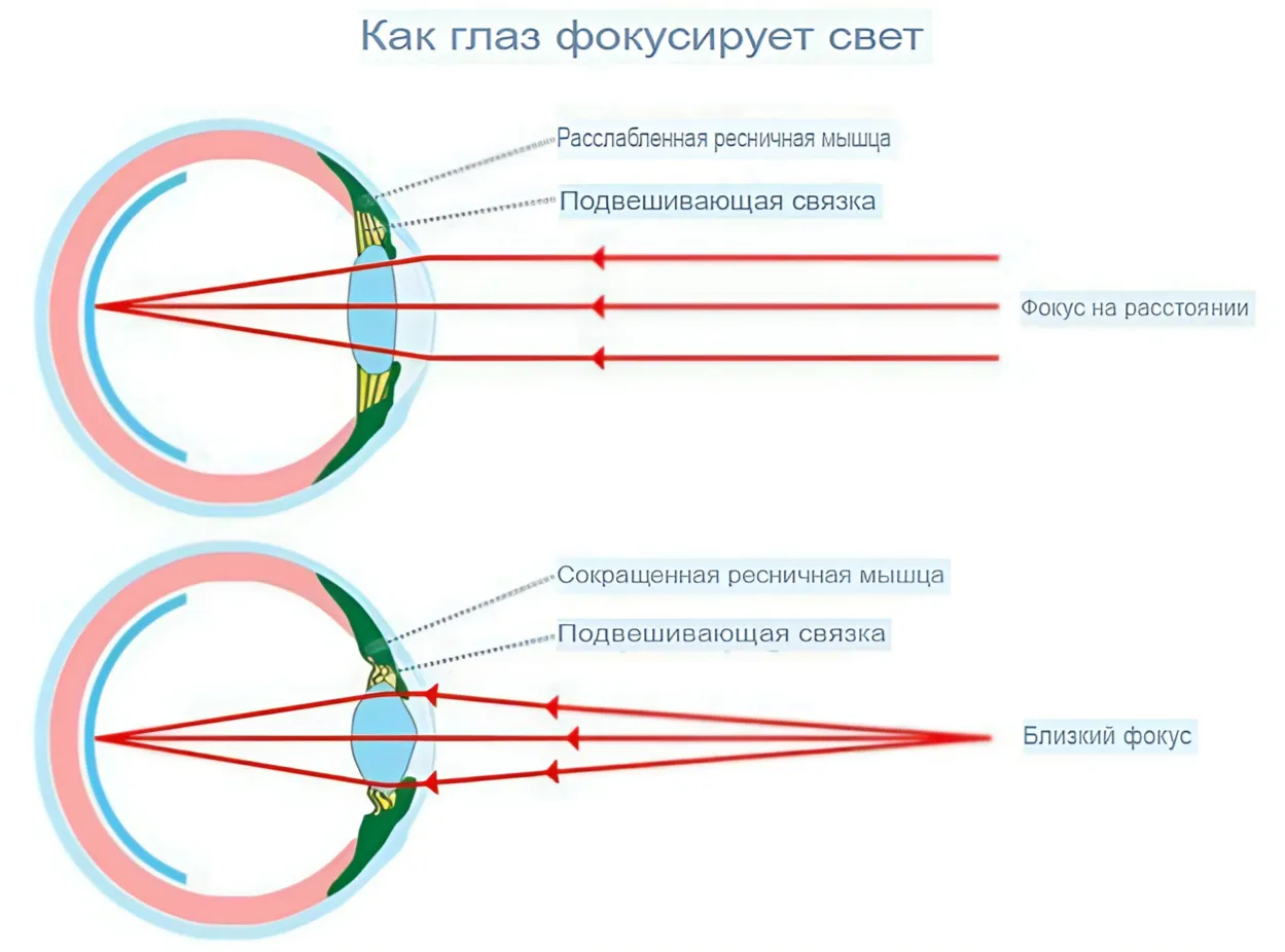 Что это такое миопия глаза?